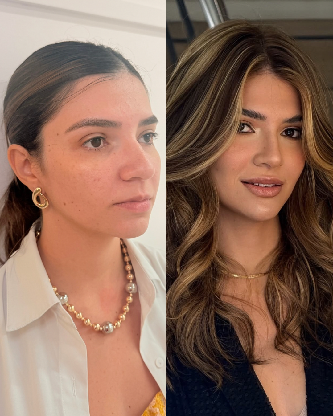 Harmonização Full Face em Fortaleza — Dra. Charlotte Oliveira